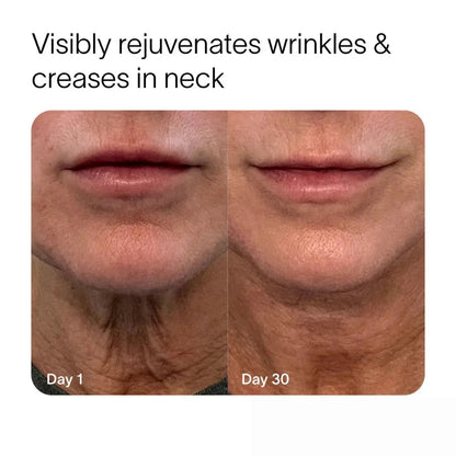 Virelli™ - 4-in-1 Skincare Wand Kit Nydras